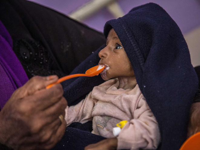 La faim provoquée par les conflits s’aggrave, selon un nouveau rapport de l’ONU